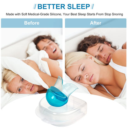 Anti-Snoring Devices - Snore Devices Stopper to Stop Snoring, Reusable Snoring Solution for Men/Women
