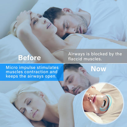 Electric Anti Snoring Device, Intelligent Throat Massager, Obvious Effect, Safe & Comfortable for Men Women All Nose Shapes and All Ages to Reduce Snoring